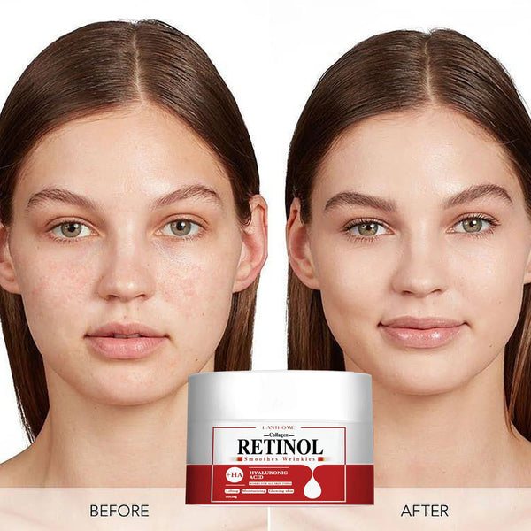 Collagen Retinol Face Cream – Anti-Wrinkle, Whitening, Moisturizing, Skin Brightening Cream