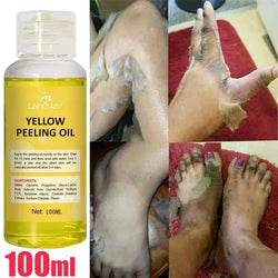 Extra Strong Yellow Peeling Oil – Skin Whitening & Exfoliating Treatment