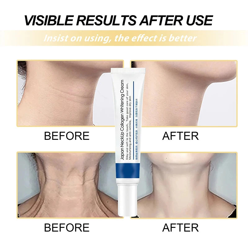 Collagen Neck Cream for Neck Up and Whitening - Rejuvenate Your Neck Today