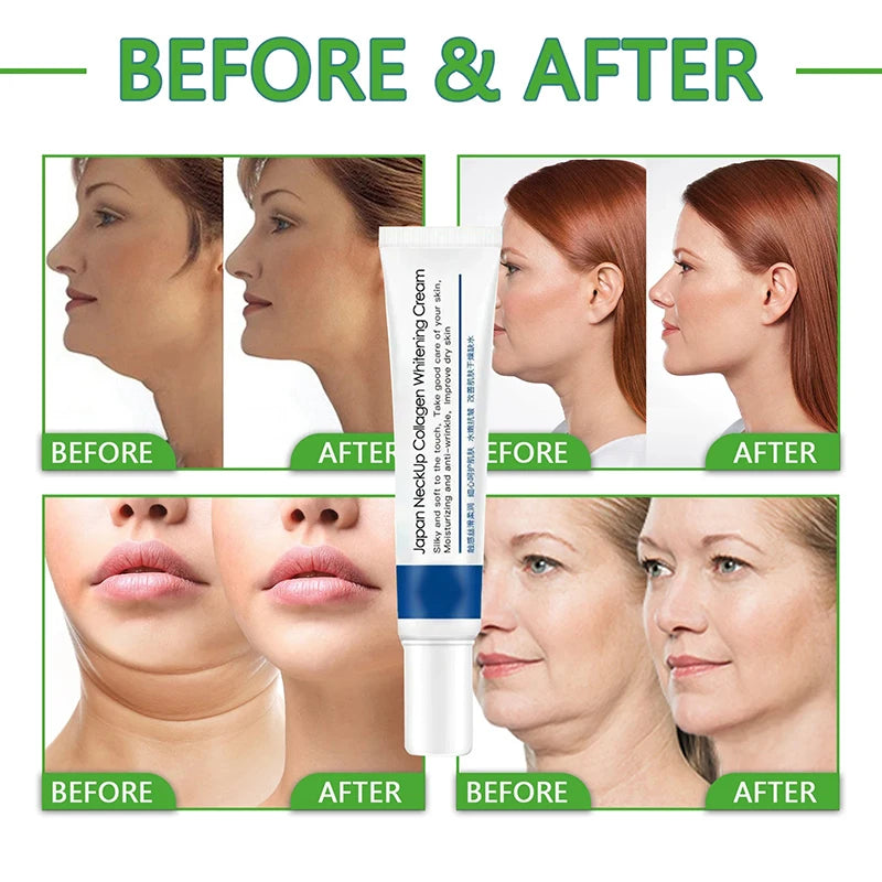 Collagen Neck Cream for Neck Up and Whitening - Rejuvenate Your Neck Today