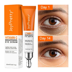 Eye Cream Anti Dark Circles Eye Bag