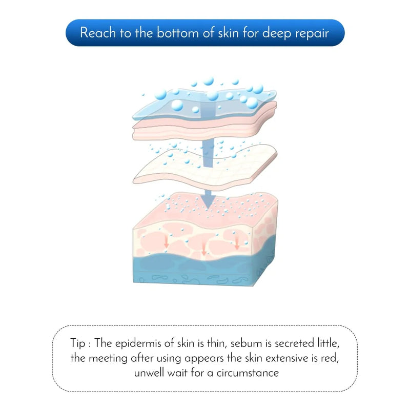 Micro Needles Skin Tightening